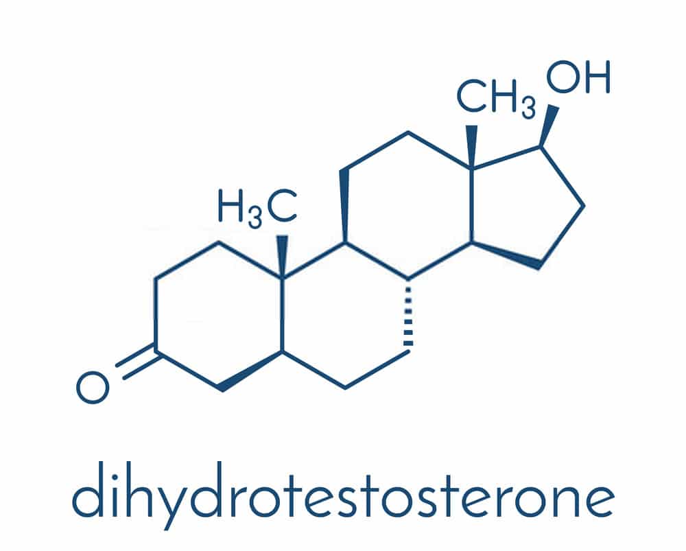 SAW PALMETTO: THE REVOLUTIONARY ANTI-HAIR LOSS MIRACLE 5 Dihidrotesterona dht